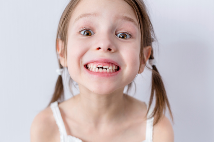 Tipos de Ortodoncia Infantil. Odontopediatría.